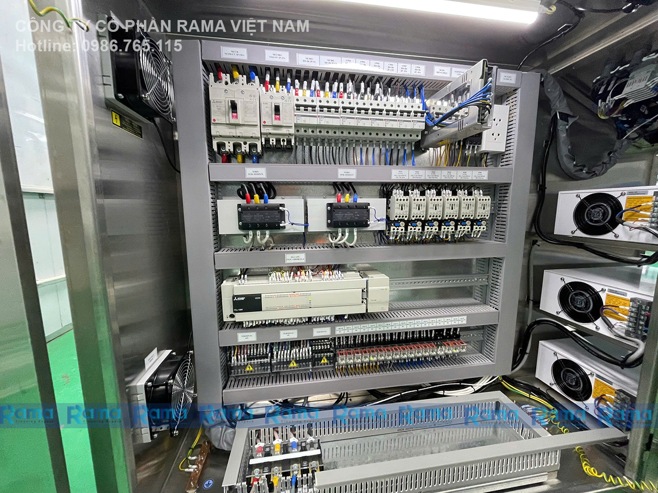 Rửa siêu âm
