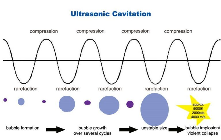 Cavitation là gì? Hiểu đúng hiệu ứng xâm thực trong làm sạch siêu âm